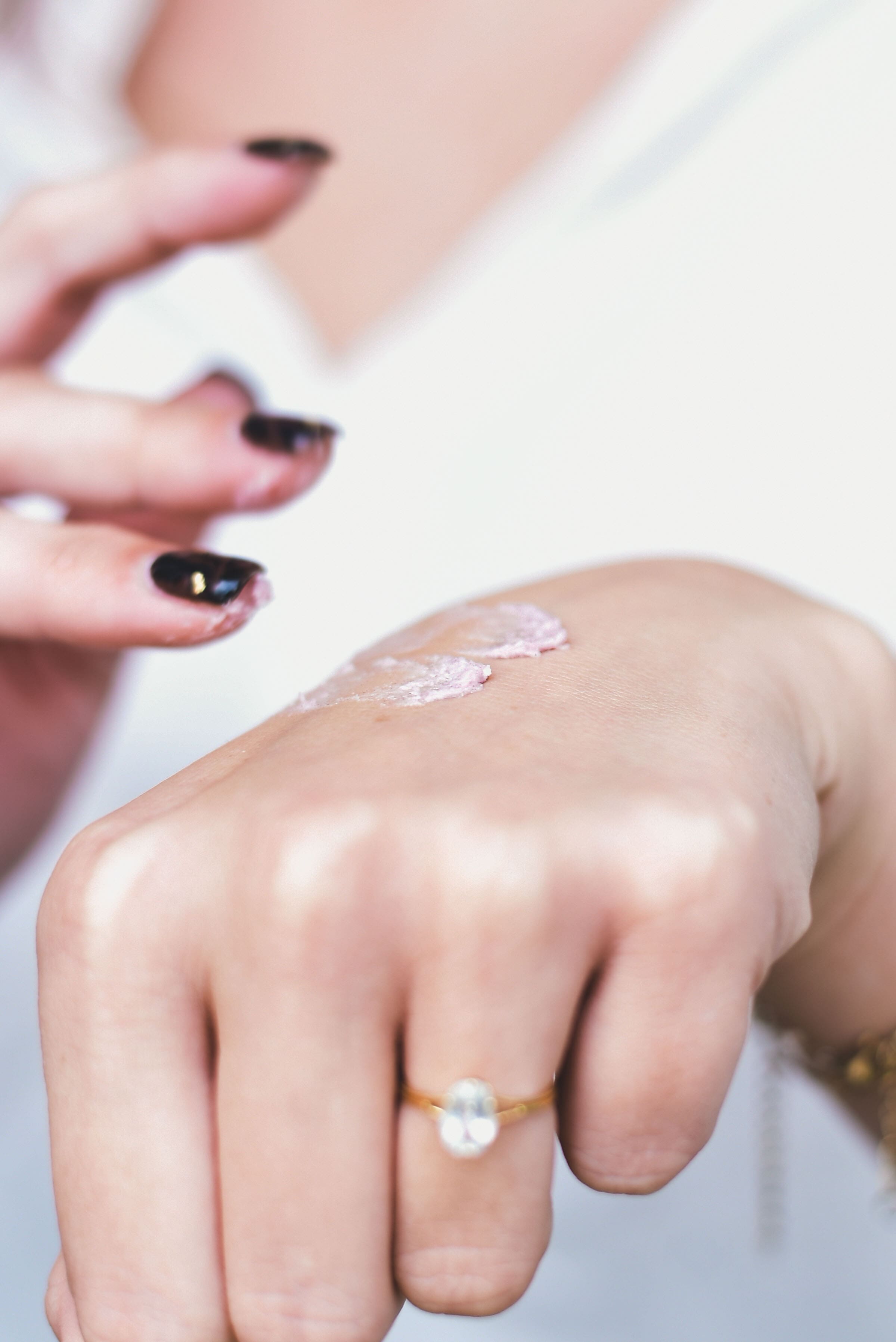 Natural remedies for eczema